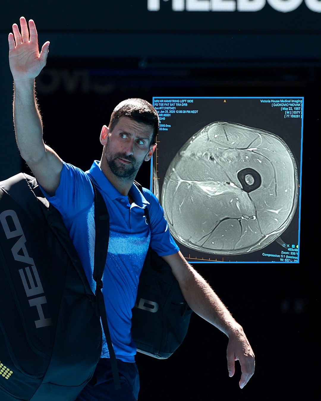 ATP总决赛绝杀美网，德约科维奇状态火热的简单介绍